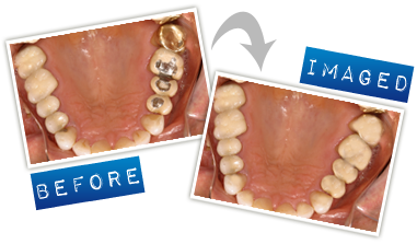 Computer software for cosmetic dental imaging